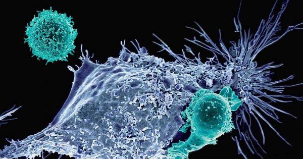 Watch Treating Esophageal Cancer With Chemotherapy video Watch Treating Esophageal Cancer With Chemotherapy video