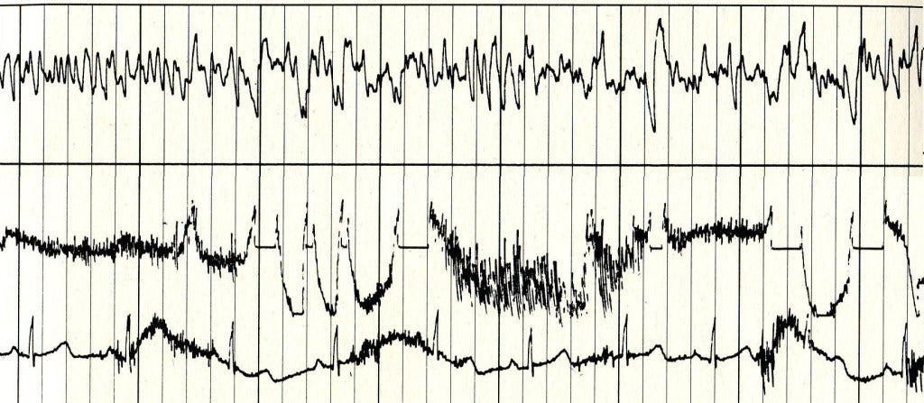 A sampling of Ann Druyan's brain waves, recorded on June 3, 1977.