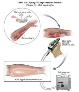 How the Skin Gun Works (Credit: Nat Geo)