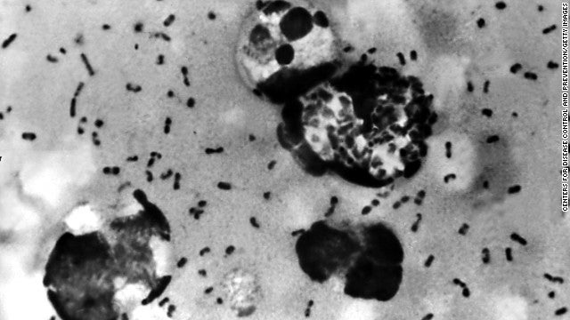 The Yersinia pestis bacteria that causes the plague. Via CDC