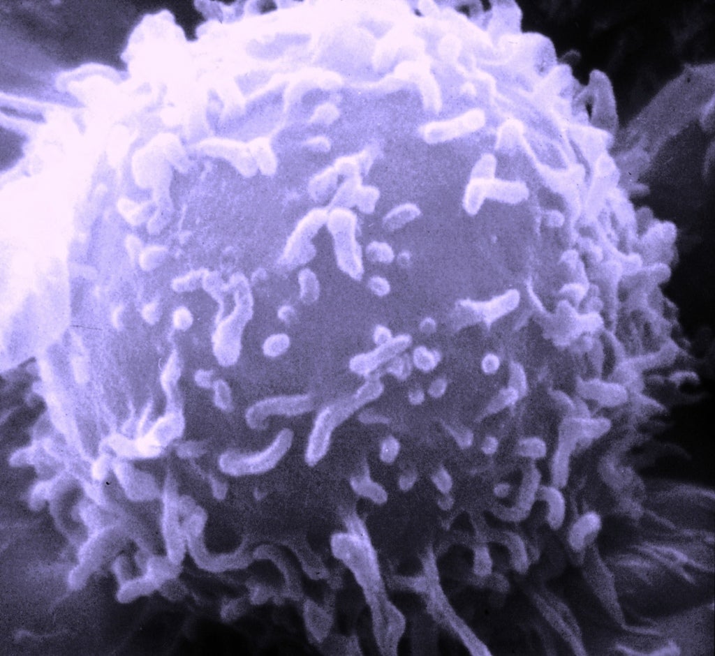 Microscope view of a lymphocyte. Image Credit: Dr. Triche/National Cancer Institute