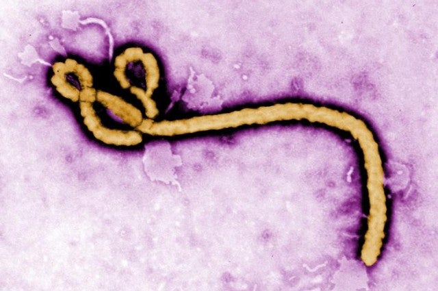 Image via CDC/ Frederick A. Murphy