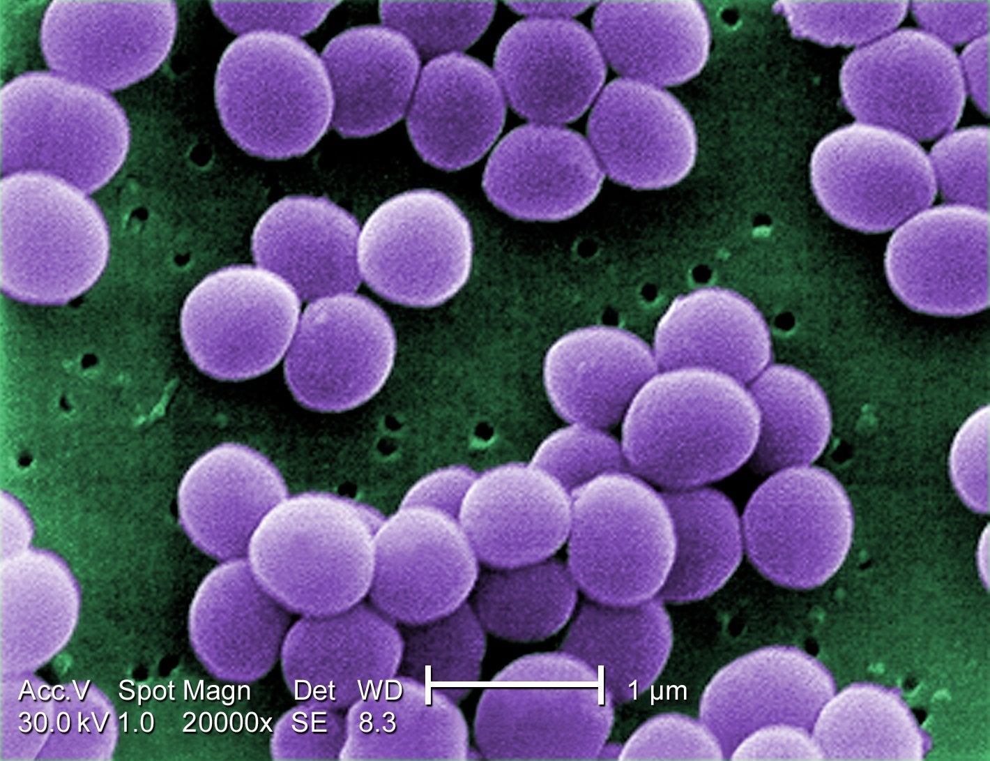 Staphylococcus_aureus_VISA_2