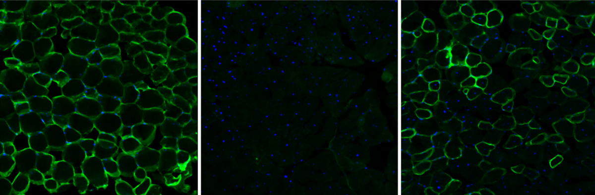 Three cross-sections of muscle tissue from mice. From left, normal, healthy tissue; tissue with Duchenne muscular dystrophy; and tissue after gene-editing treatment. Credit Christopher Nelson