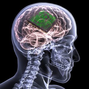 http://www.futuretimeline.net/21stcentury/images/memory-chip-brain-implant.jpg