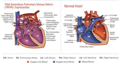 Image Credit: Cardiac Center at The Children's Hospital of Philadelphia