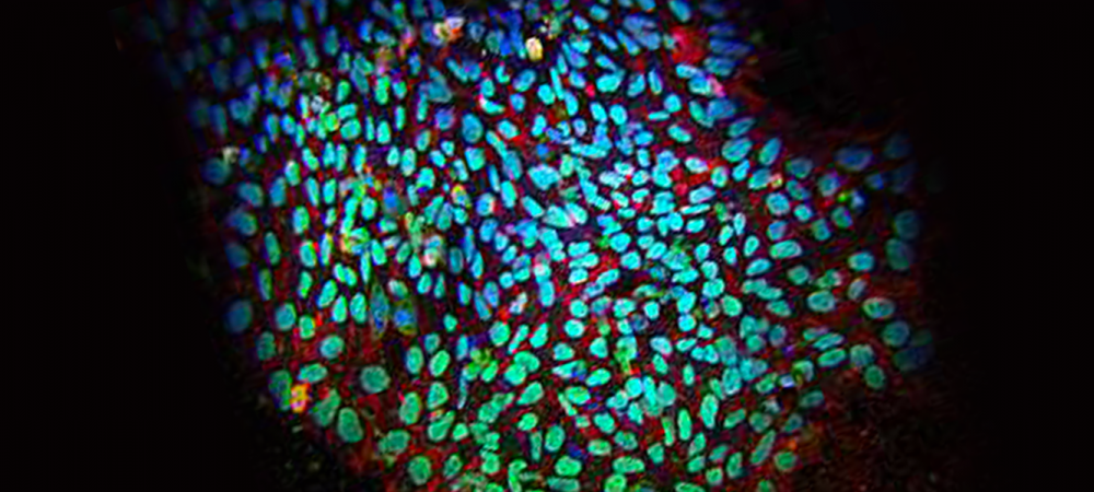 A colony of iPSCs. Red and green are markers of pluripotency. Credit: Salk Institute for Biological Studies