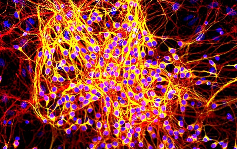 Amyloid Beta Protein Image by Gerry Shaw