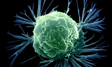 breast-cancer-cell-460x276