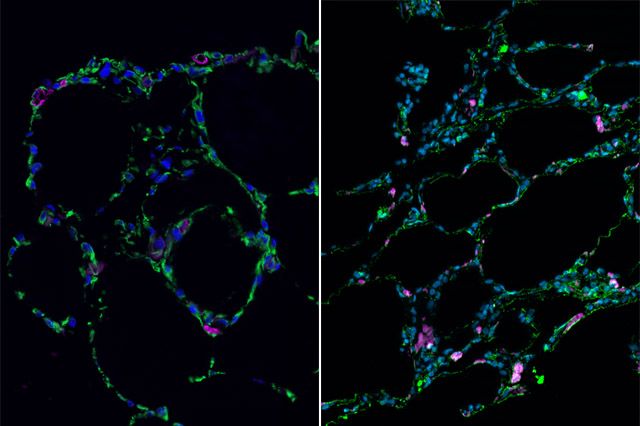 Lab-grown lung-mimicking tissue (left) in comparison with real human lung tissue (right). UCLA Broad Stem Cell Research Center.