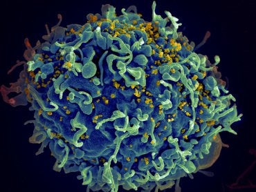 HIV-infected T cell. Credits: NIH