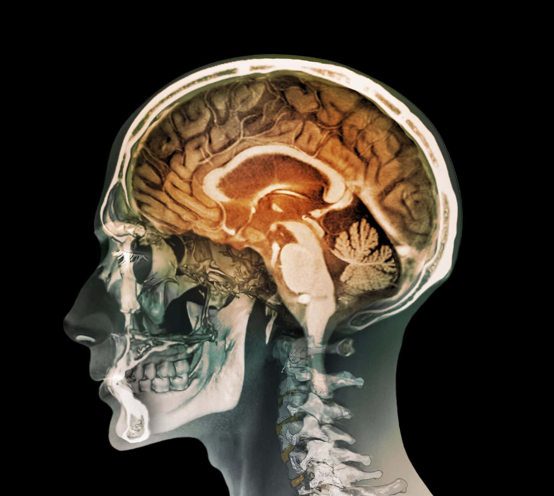 Fda Approved Youthful Brain? The Shocking Truth! - w72jioh