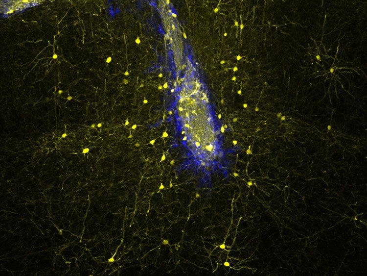 Credit: Sofia Grade (LMU/Helmholtz Zentrum München)