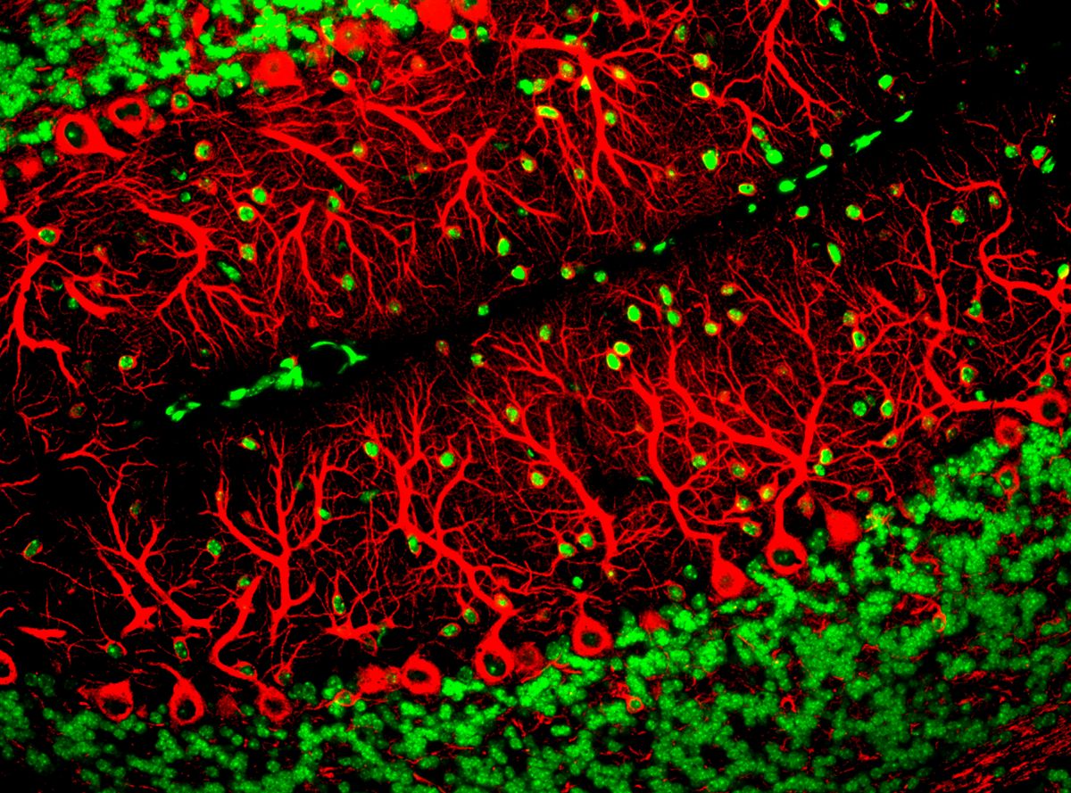 Purkinje Cells (In Red). Image Credit: ZEISS Microscopy, Flickr 