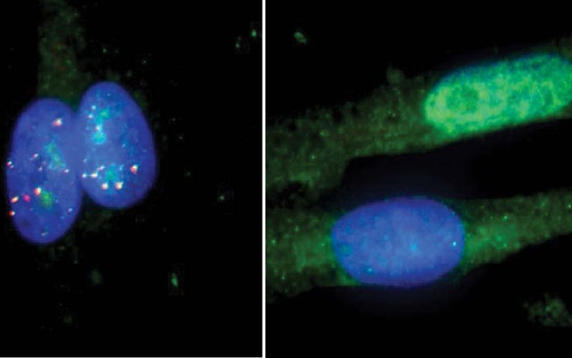 crispr-cas9 rcas9 als gene editing