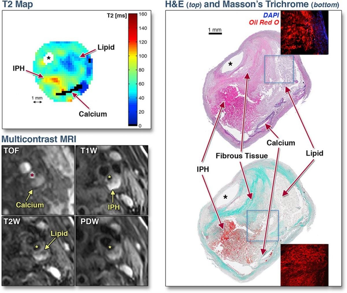 Image Credit: Chai et al.