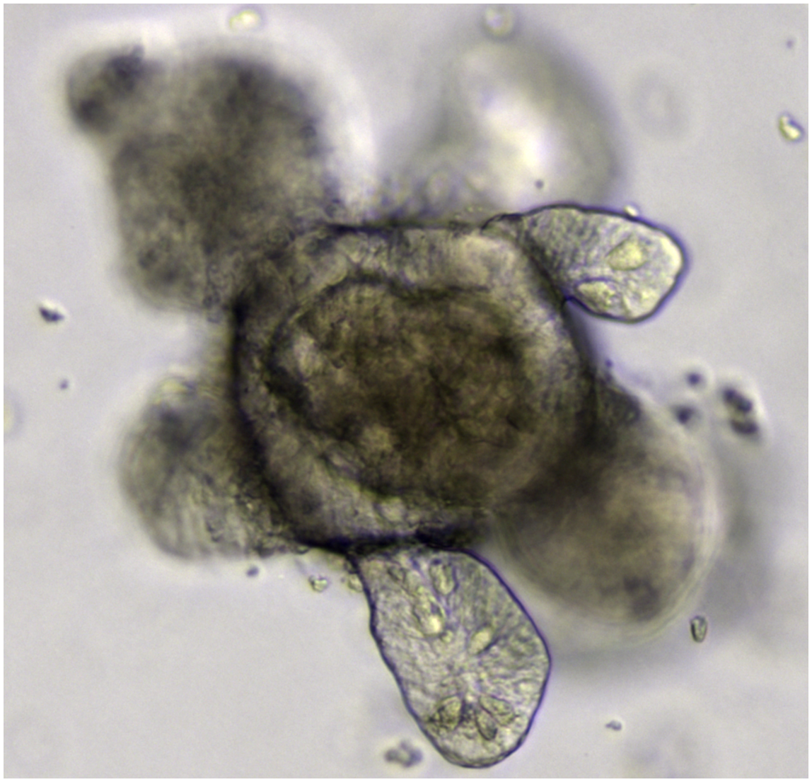 An intestinal organoid. Image Credit: Wikipedia