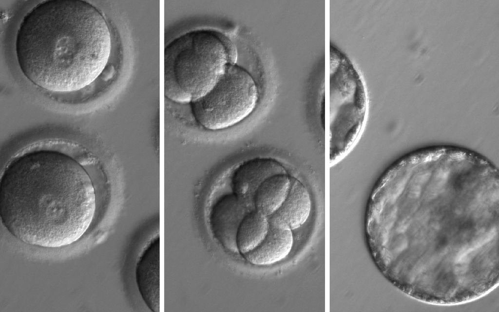 Image Credit: Oregon Health & Science University