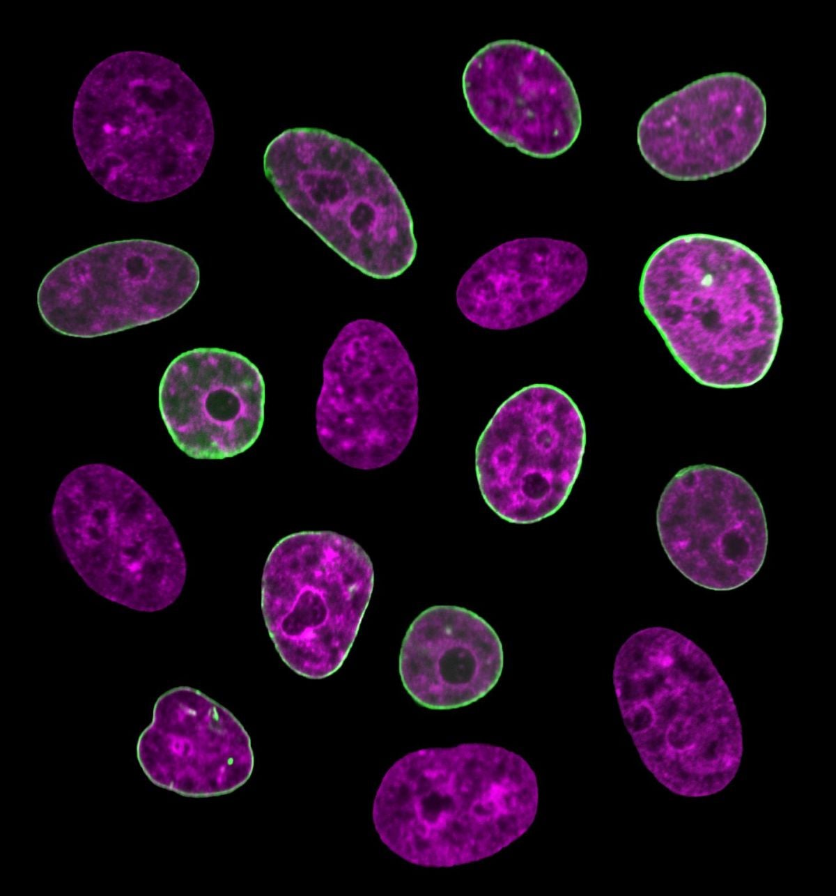 Human cell nuclei with the nuclear envelope highlighted in green. Image Credit: New York University/Alexandra Zidovska/Fang-Yi Chu