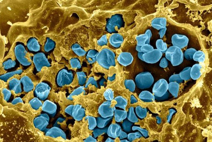 An image of blue Francisella tulamensis bacteria attacking yellow immune cells from a mouse (Image Credit: National Institute of Allergy and Infectious Disease)