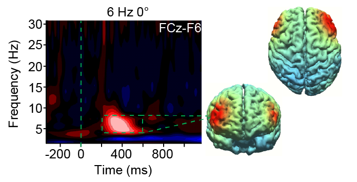 A scan of a brain involved in the study shows how brain stimulation lights up the medial frontal cortex and prefrontal cortex, both involved in how people learn.