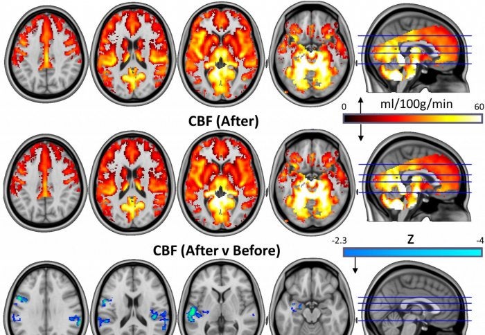 psychadelics magic mushrooms psilocybin mental health