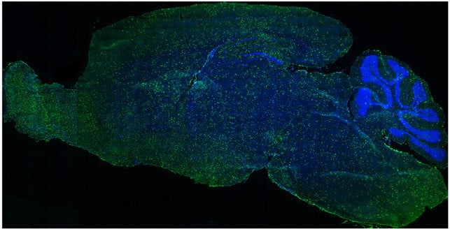 Brain of a mouse injected with the genetically engineered immune cells, which have distributed widely. This treatment has the potential to repair and regenerate brain tissue.