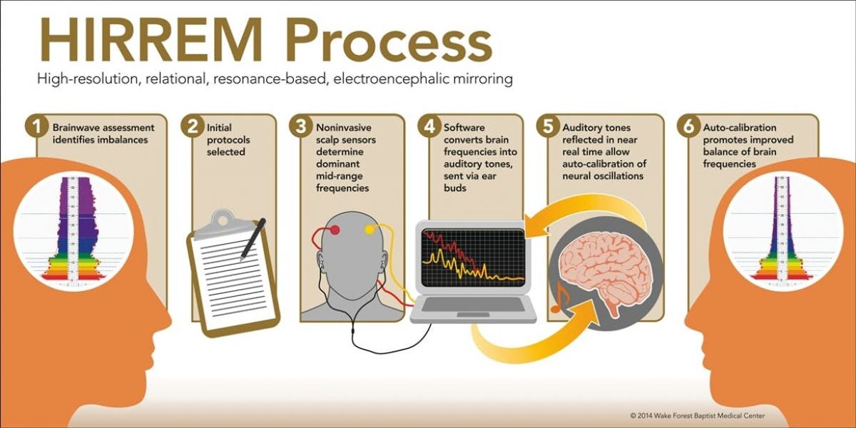 The HIRREM Process. Image Credit: Wake Forest Baptist Medical Center 