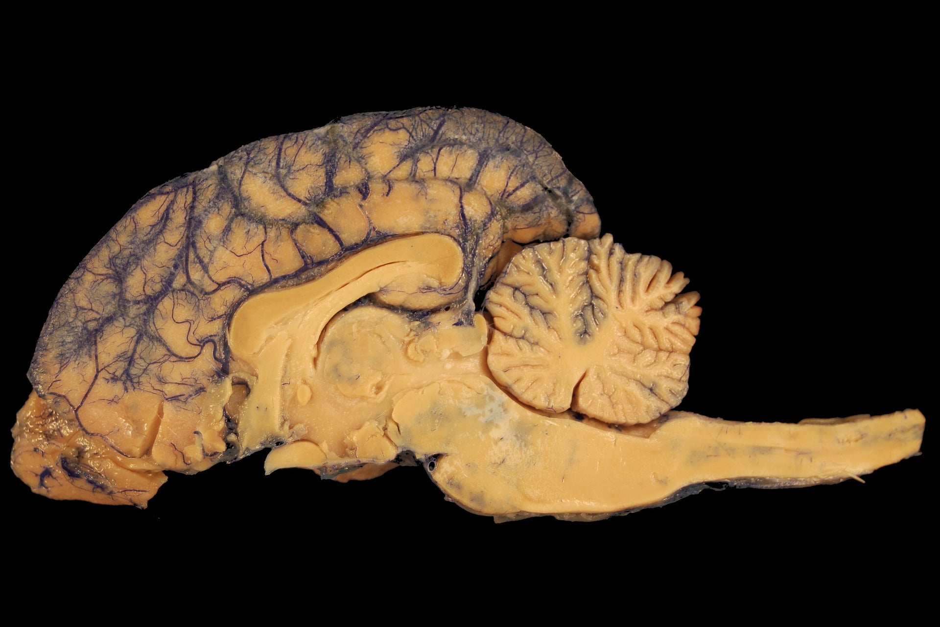 physicists-overturn-a-100-year-old-assumption-on-how-brains-work