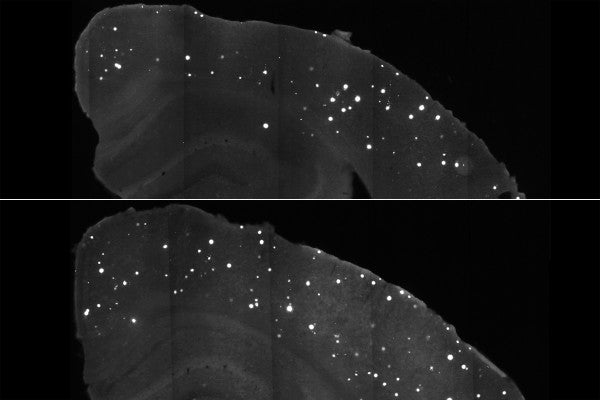 Fewer white spots representing damaging proteins appear in the brains of mice treated with a DNA-based compound, suggesting it may be a way to treat or prevent Alzheimer's.