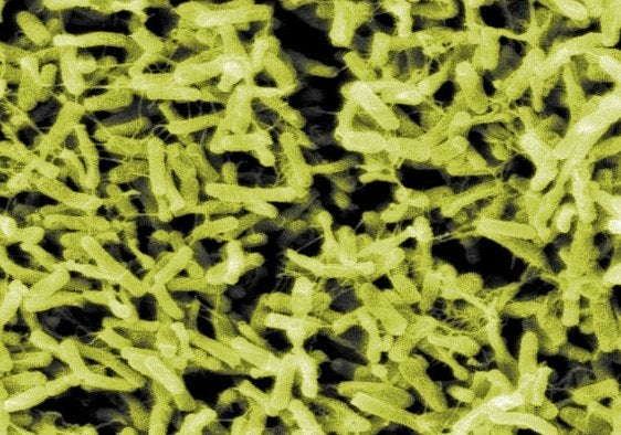 Yellowish clusters of Clostridium difficile, the bacterial gut infection that fecal transplants have proven robust at treating.