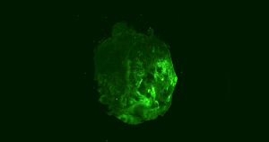 A new virtual reality simulation built by Cambridge University scientists gives a high-resolution detail view into the cells of a breast cancer tumor.