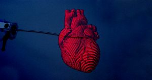 Surgeons just used the first autonomous surgery robot, a self-guiding catheter that could navigate its way through a pig's heart.