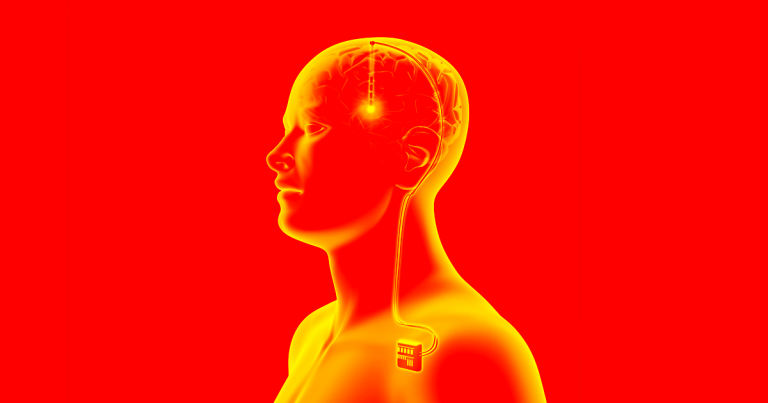 In China, Surgeons Are Treating Addiction With Brain Implants