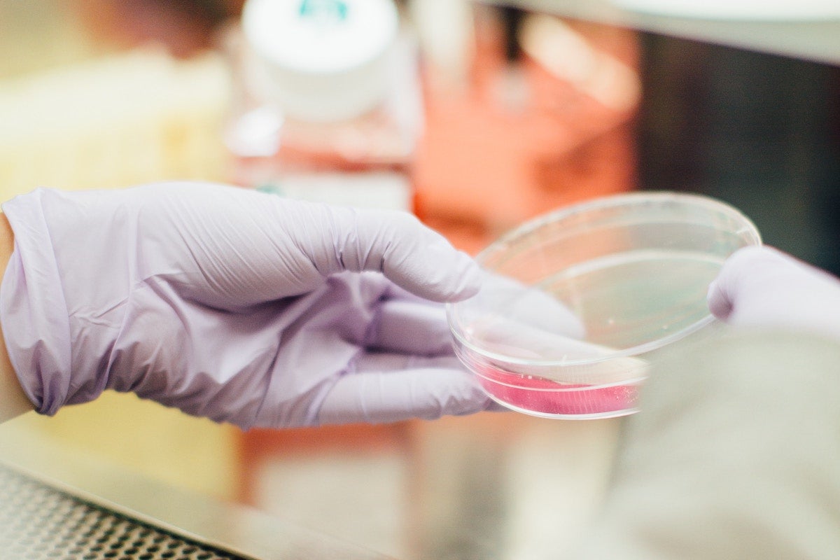 Viome Gut Microbiome Test