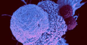 As the pandemic begins its 15th official year, doctors are seeing severe cancer cases that went ignored for too long for one reason or another.