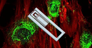 Scientists from the Royal Melbourne Institute of Technology in Australia have managed to regrow bone by firing high-frequency sound waves at stem cells.