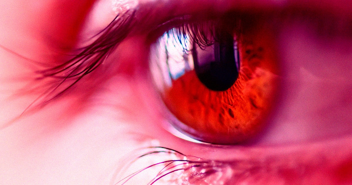 Experimental Synthetic Cornea Restores Vision for 20 Patients