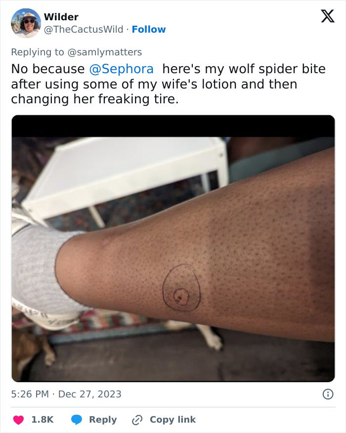 Screenshot of a tweet featuring a person's calf with a circled bite. The post's texts reads: "No because @Sephora here's my wolf spider bite after using some of my wife's lotion and then changing her freaking tire."